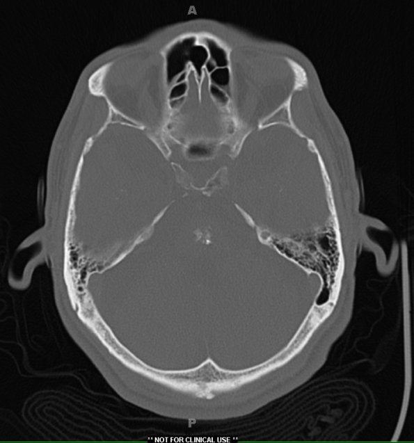 2A6 (Case 2)  CT 10-3-2012 CT 3