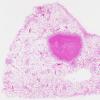 1C3 TB (Case 1) Lung 2 H&E whole mount