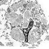 1F3 Whipple's Dz (Case 1) amygdala 032 - CopyA