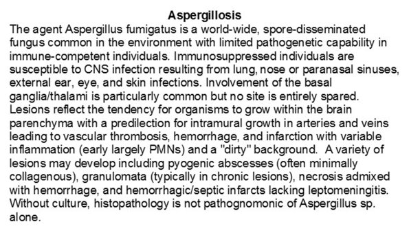 Aspergillosis Text - Overview