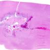 7A1 Aspergillosis (Case 7) H&E whole mount