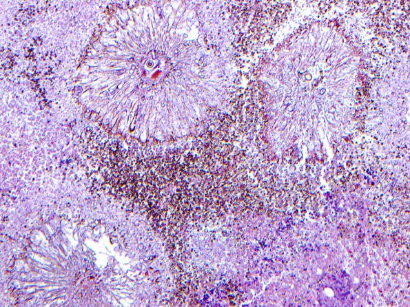 5A1 Aspergillus Niger_01 copy