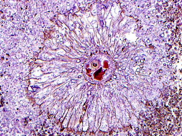 5A2 Aspergillus Niger_02 copy