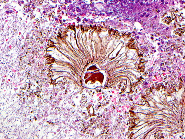 5A3 Aspergillus Niger_03 copy