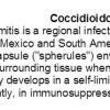 0A Coccidioidomycosis text