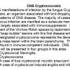 0 Cryptococcosis Overview