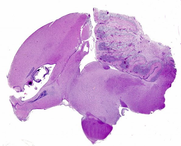 1A1 Fungus, Quail brain Dactylaria H&E whole mount