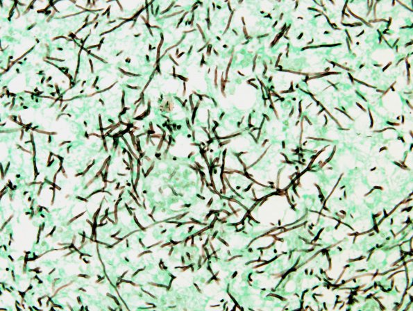 1B2 Fungus, Quail brain Dactylaria GMS 1