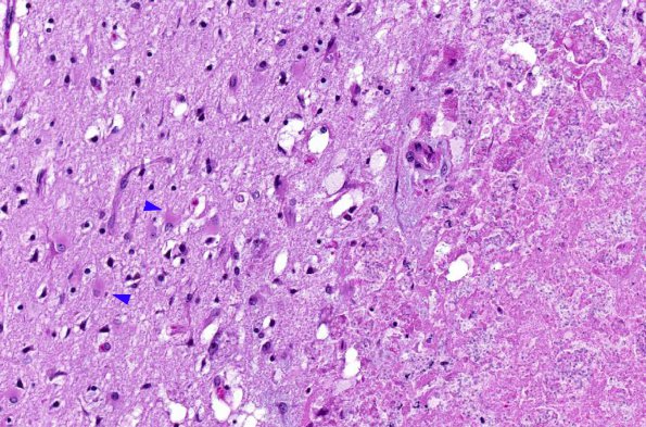 1A4 Microsporidiosis (AANP 1997 - Case 6) H&E 10 copy