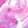 1B2 Cysticercosis (Case 1) H&E 4X