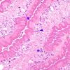 1B4 Cysticercosis (Case 1) H&E 2