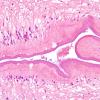 1B5 Cysticercosis (Case 1) H&E 8