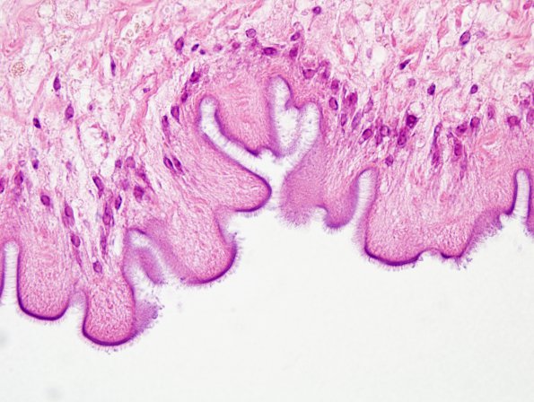 1B7 Cysticercosis (Case 1) H&E 13