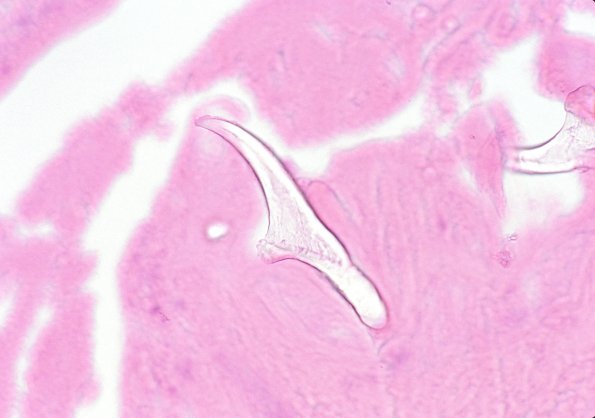 2A4 Cysticercosis (Case 2) H&E 4