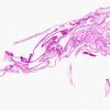 3C1 Cysticercosis (Case 3) whole mount