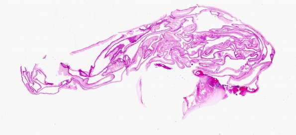 3C1 Cysticercosis (Case 3) whole mount