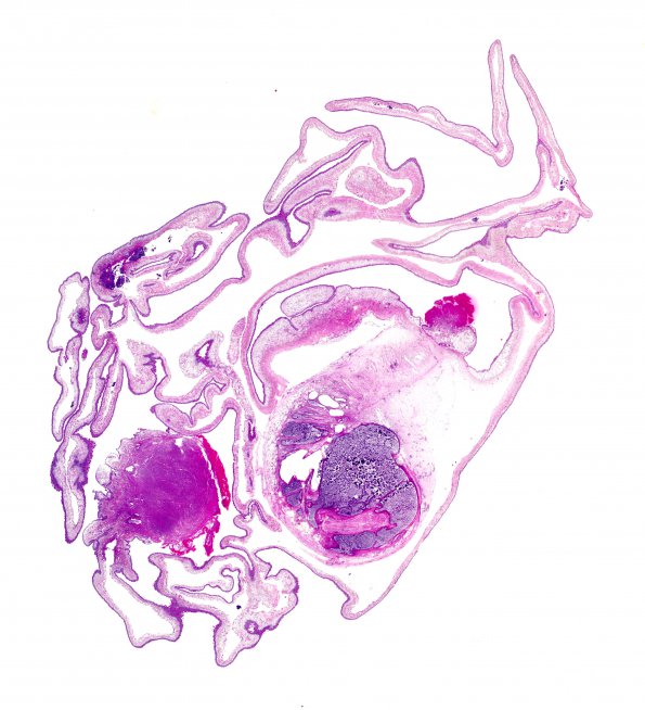 7A1 Cysticercosis (Case 7) H&E whole mount