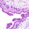 7A4 Cysticercosis (Case 7) H&E 3