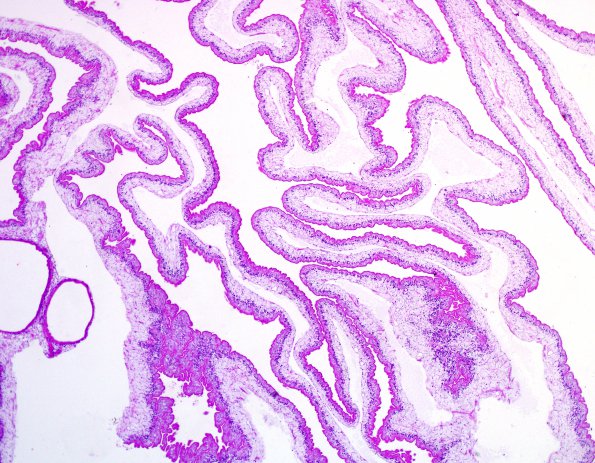 8A1 Cysticercosis (Case 8) H&E 5