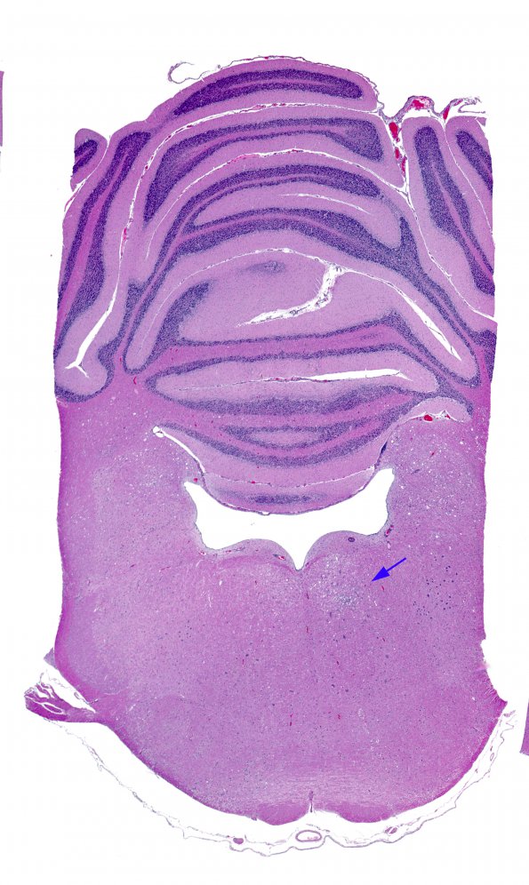 1A1 Parasite tracks (Zoo B97-11-1, rabbit)  H&E whole mount