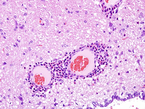 1A3 Parasite tracks (Zoo B97-11-1, rabbit)  H&E 10A