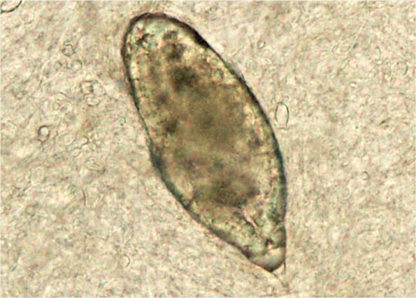 1C1 Schistosomiasis haematobia, cerebrum (Case 1) Lab preparation