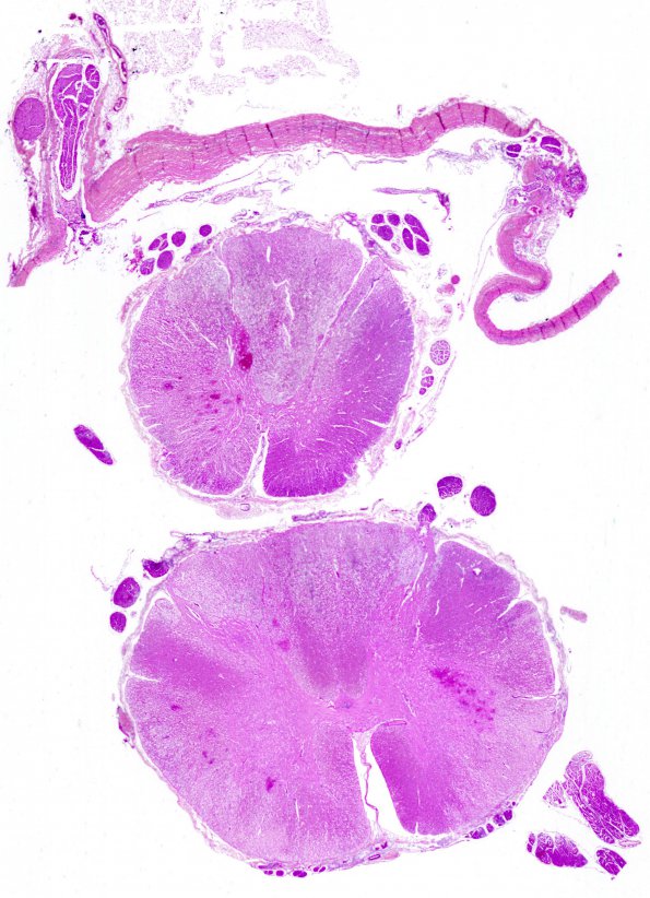 9A1 Amoeba (Case 4) 2A