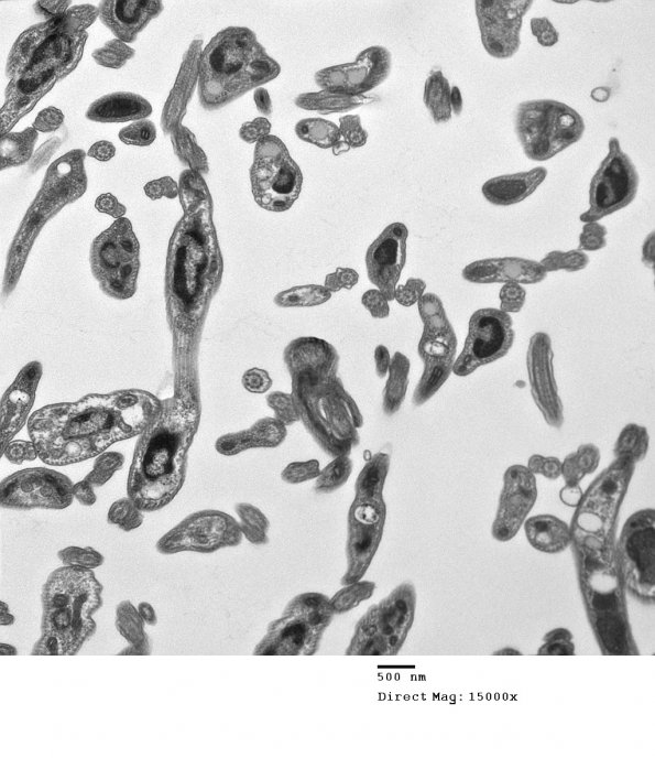 4A1 Plasmodium sp (Case 4) EM 1 - CopyA