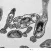 4A2 Plasmodium sp (Case 4) EM 2 - Copy