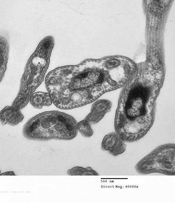 4A2 Plasmodium sp (Case 4) EM 2 - Copy