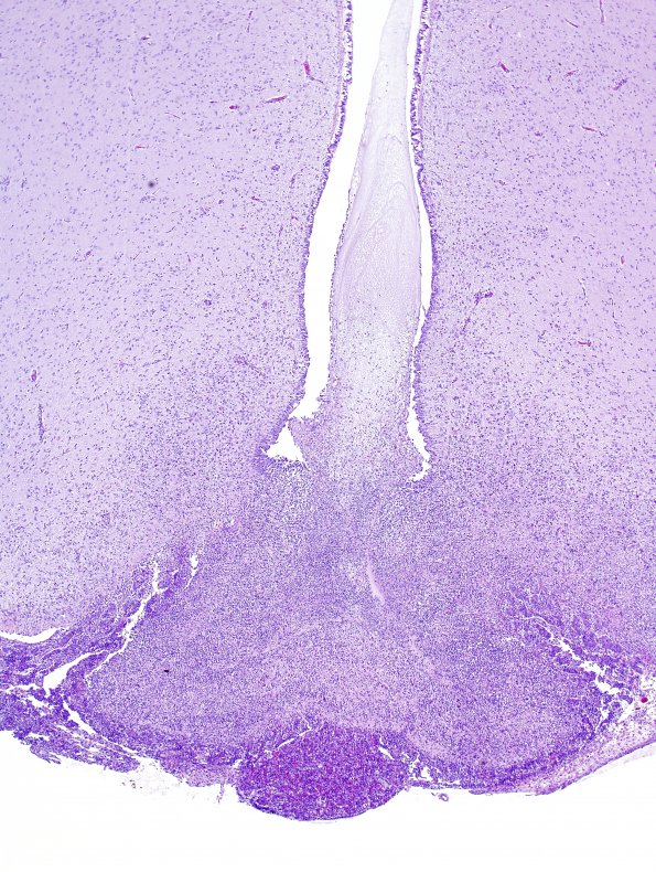 1A2 Sarcocystis (ZOO Raccoon (SW14-1700 B49-14-2) H&E 17