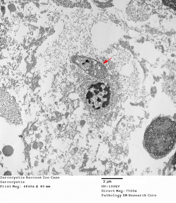 2A1 Sarcocystis Raccoon Zoo Case (R14-98)_018 - Copy