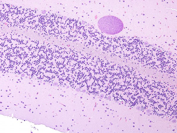 3A1 Sarcocystis (Zoo 14574, otter) H&E 2A