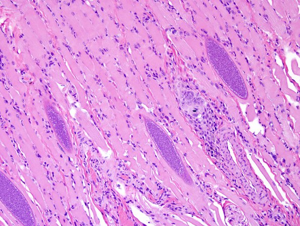 5A1 Sarcocystis, raccoon tongue (Zoo B822-14) H&E 2