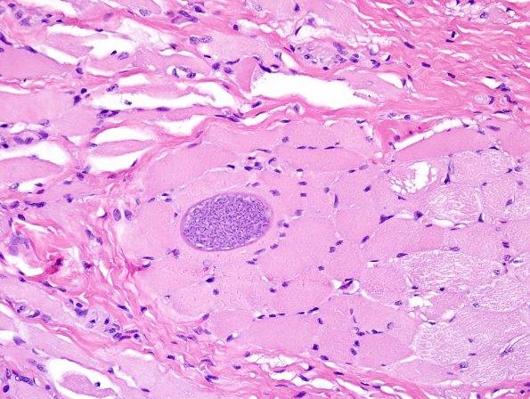 5A2 Sarcocystis, raccoon tongue (Zoo B822-14) H&E 3