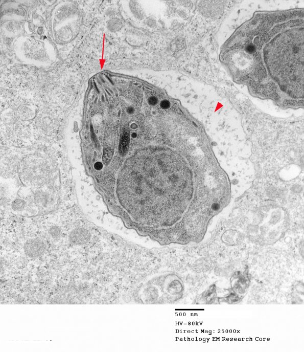 14A2 Toxoplasmosis Zijiang 2-11-08_003 - Copy A