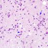 3A1 Toxoplasmosis (Case 3) H&E  3A