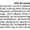 0A Adult CMV Encephalitis