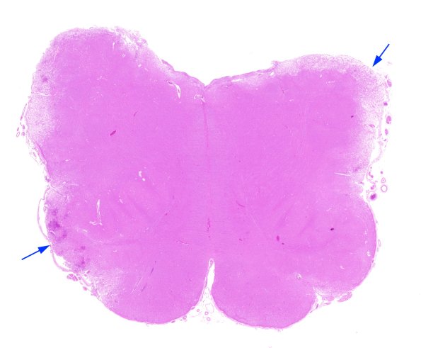 3C1 CMV Medulla (Case 3) N8 H&E whole mount copy