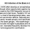 0A Neonatal HIV Text