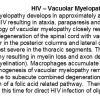 0A HIV - Vacuolar Myelopathy