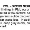 0A PML Gross Pathology - Text