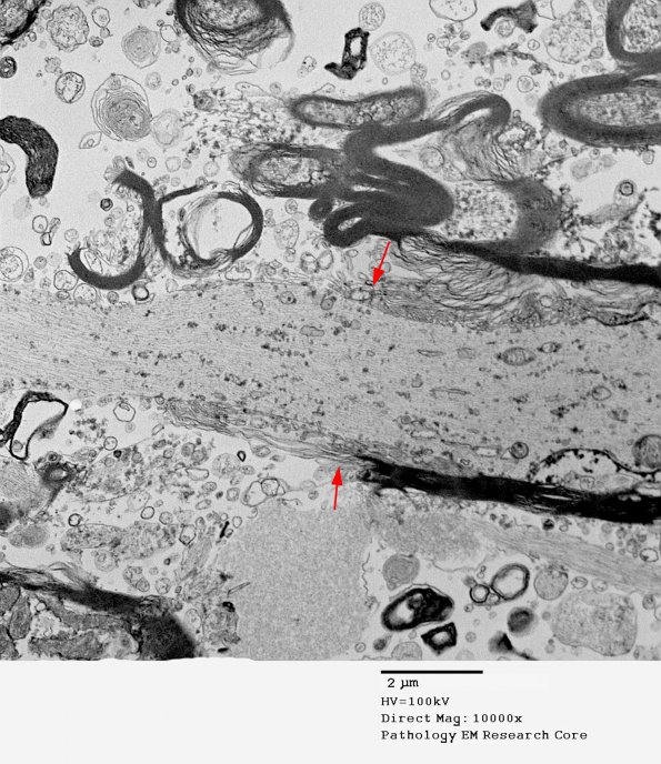 1I9 PML 6 peduncle EM 009 copy - Copy