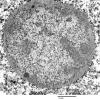 2I1 PML (Case 2) N6 peduncle EM 055 - Copy - Copy