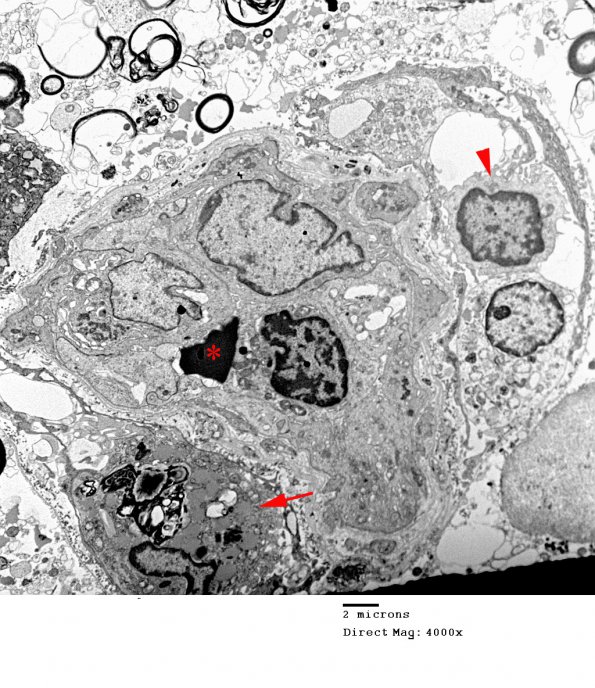 1B4 PML (Case 2) EM 044 copy - Copy