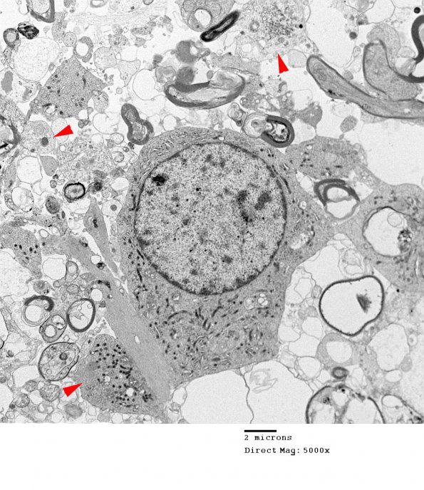 1B7 PML (Case 2) EM 045 copy - Copy