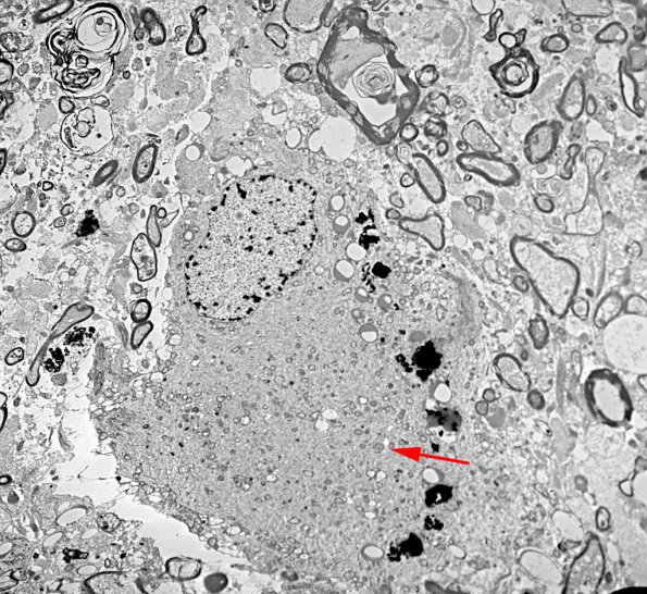 1E2 PML (Case 1) EM 050 copy - Copy