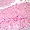 1H5 Granule cell neuronopathy (Case 1 Autopsy specimen) N14 ISH 24 copy