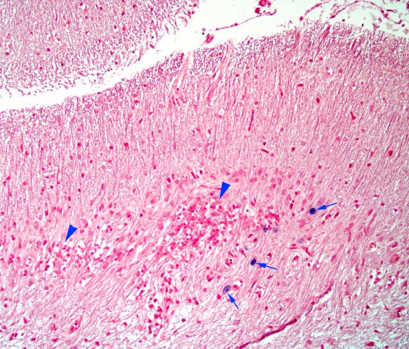 1H5 Granule cell neuronopathy (Case 1 Autopsy specimen) N14 ISH 24 copy