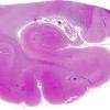 1A1 Rabies (AANP 1997-08) Hippocampus H&E whole mount